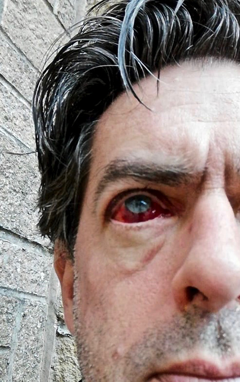 Terminator eye, 4/5/19